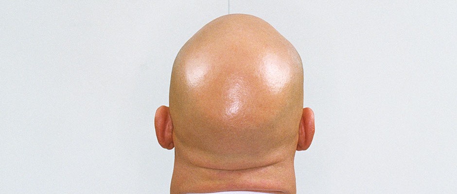 jeffbezosforeskin